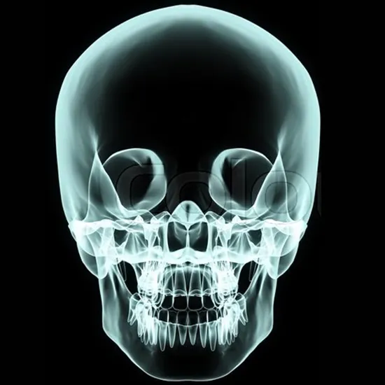 X-ray Skull